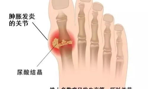 玉屏风颗粒能预防感冒吗-玉屏风颗粒同仁堂牌网-分享玉屏风口服液与玉屏风颗粒哪个好，玉屏风颗粒能治荨麻疹吗知识库